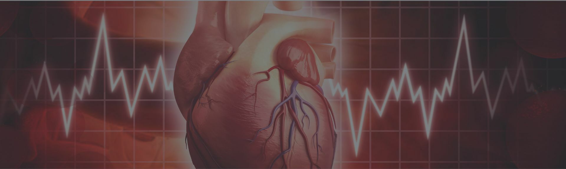 EMERGENZE CARDIOLOGICHE E LETTURA ECG, CON CASI CLINICI